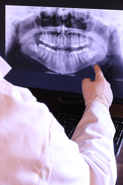 Best Emergency Tooth Extraction in Zebulon, GA